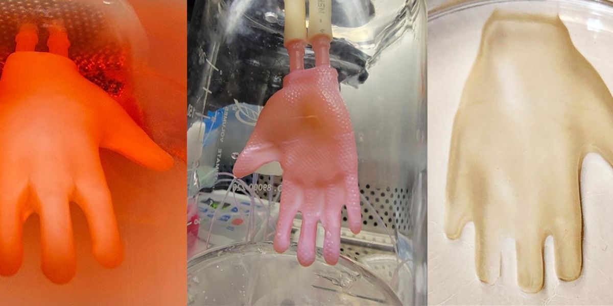 Creating a "glove" of engineered skin begins with a 3D-printed scaffold and ends three weeks later with a construct ready for grafting. Images: Alberto Pappalardo and Hasan Erbil Abaci / Columbia University Vagelos College of Physicians and Surgeons.