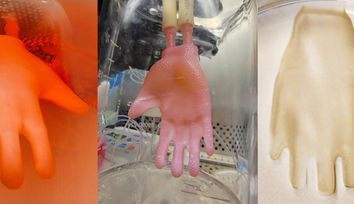 Bioengineered Skin Grafts that Fit Like a Glove