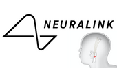 Neuralink: The Company That Wants To Put A Chip In Your Head