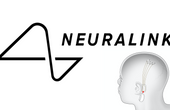 Neuralink: The Company That Wants To Put A Chip In Your Head