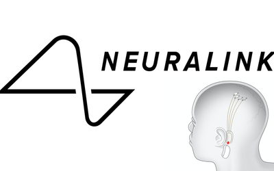 Neuralink: The Company That Wants To Put A Chip In Your Head