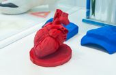 3D Printing in Healthcare: Engineering Applications and Impact