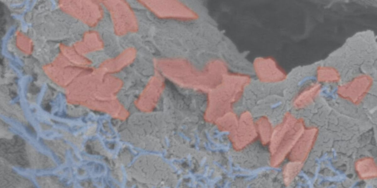 The scaffold consists of a soft hydrogel (gray) that contains carbon nanotubes (blue) and graphene flakes (red) as conductive materials to transmit electrical impulses throughout the scaffold. (Wyss Institute at Harvard University)