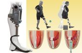 A bionic knee integrated into tissue can restore natural movement