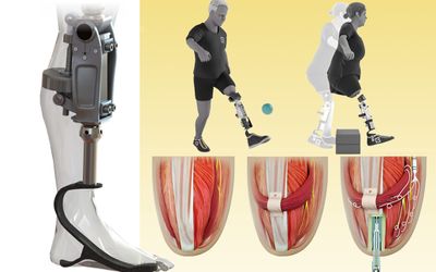A bionic knee integrated into tissue can restore natural movement
