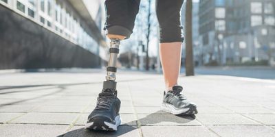 ETH researchers have developed a prosthetic leg that communicates with the brain via natural signals. (Photograph: Keystone)