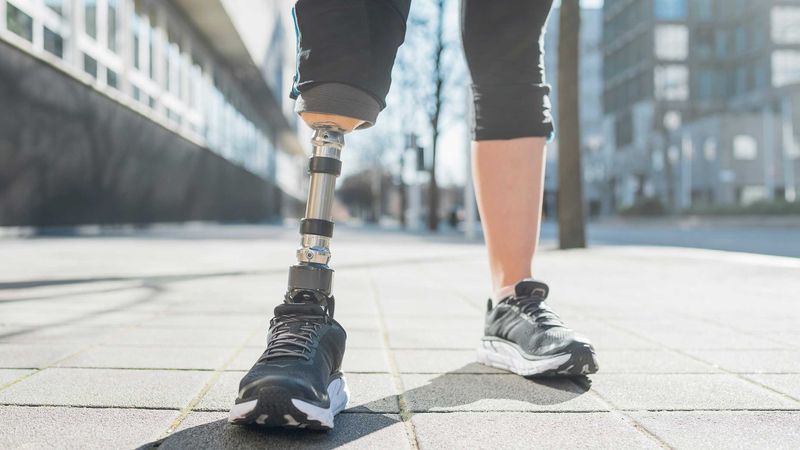 ETH researchers have developed a prosthetic leg that communicates with the brain via natural signals. (Photograph: Keystone)