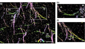 Machine learning generates pictures of proteins in 5D