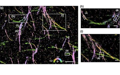 Machine learning generates pictures of proteins in 5D