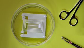 Engineers design flexible "skeletons" for soft, muscle-powered robots