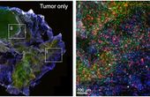 Introducing 'BioArm' - the portable 3D bioprinter joining the fight against cancer