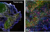 Introducing 'BioArm' - the portable 3D bioprinter joining the fight against cancer