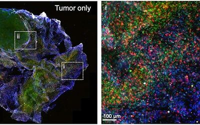 Introducing 'BioArm' - the portable 3D bioprinter joining the fight against cancer