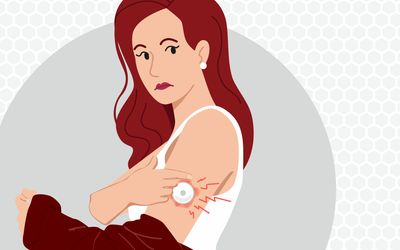 An Alternative Adhesive for Wearable Medical Devices