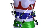 First Dynamic Spine Brace-Robotic Spine Exoskeleton-Characterizes Spine Deformities