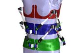 First Dynamic Spine Brace-Robotic Spine Exoskeleton-Characterizes Spine Deformities