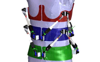 First Dynamic Spine Brace-Robotic Spine Exoskeleton-Characterizes Spine Deformities