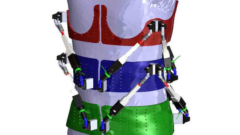 Robotic Spine Exoskeleton consists of two six-degrees-of-freedom parallel-actuated modules connected in series, each with six actuated limbs. Each module controls the translations/rotations or forces/moments of one ring in three dimensions with respect to the adjacent ring. Video & Images: Sunil Agrawal/Columbia Engineering