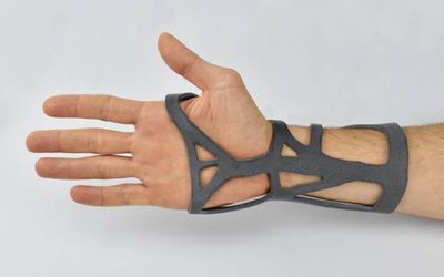 3D printing medical devices: What are the advantages ?