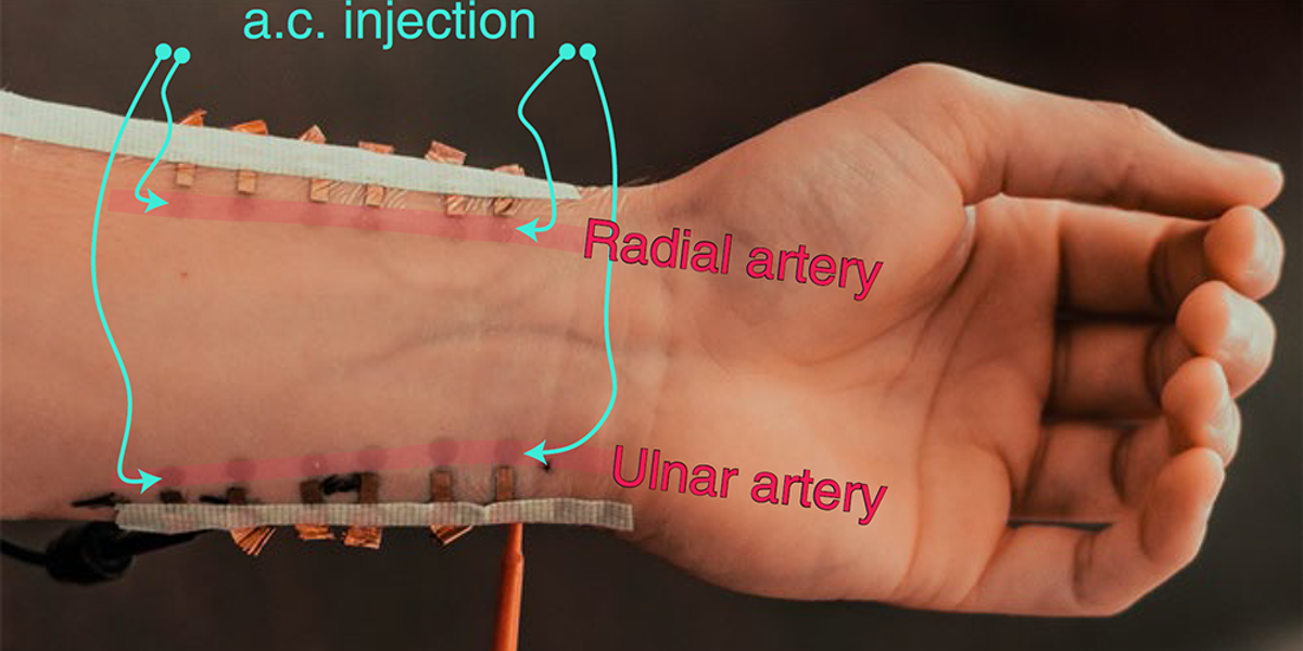 Graphene-based sensors are nearly invisible under the red markings, which are used to measure blood pressure. | Image: Courtesy of Dr. Roozbeh Jafari.