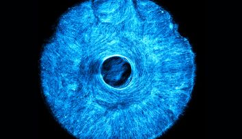 Artificial muscle flexes in multiple directions, offering a path to soft, wiggly robots
