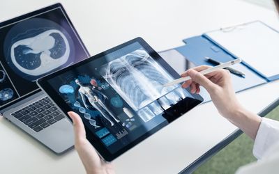 Transforming healthcare with digital therapeutics