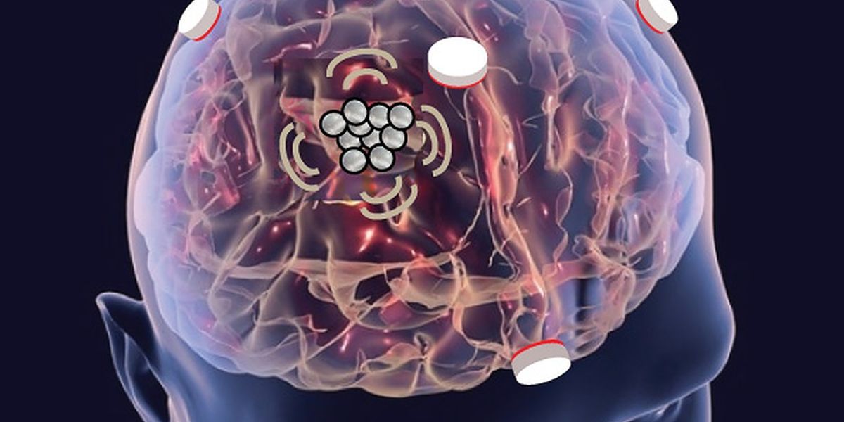 Hong Chen and her team are developing tiny sensors to detect blast-induced traumatic brain injury with new funding from the Office of Naval Research. (Credit: Chen lab)