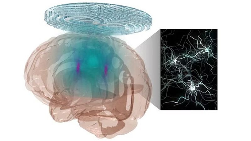 McKelvey School of Engineering researchers have developed a noninvasive technology combining a holographic acoustic device with genetic engineering that allows them to precisely target affected neurons in the brain, creating the potential to precisely modulate selected cell types in multiple diseased brain regions. (Credit: Yaoheng Yang)