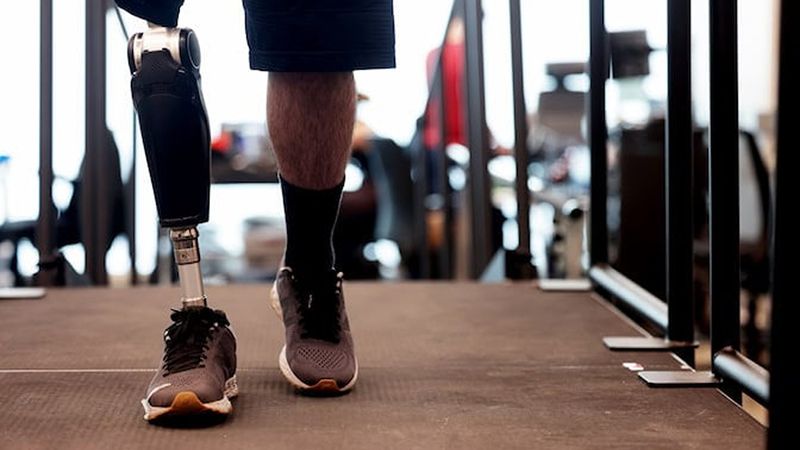 Expanding a commercial robotic prosthetic leg's benefits with advanced control