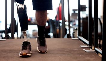 Expanding a commercial robotic prosthetic leg's benefits with advanced control