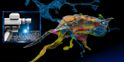 MIT researchers invented a technology and software to take electron microscopy to the next level by seamlessly integrating real-time machine learning into the imaging process — “smart microscopy.” Left image: Yaron Meirovitch via the Stable Diffusion XL AI image generator and Alex Shipps via the Midjourney AI image generator. Right image: Daniel Berger and Meirovitch, edited by Alex Shipps/MIT CSAIL