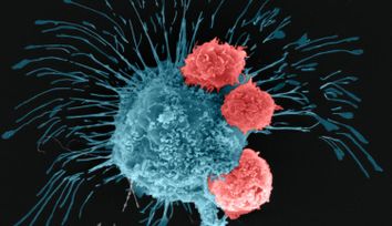 Podcast: Finding Better Cancer Cures By Printing Tumors