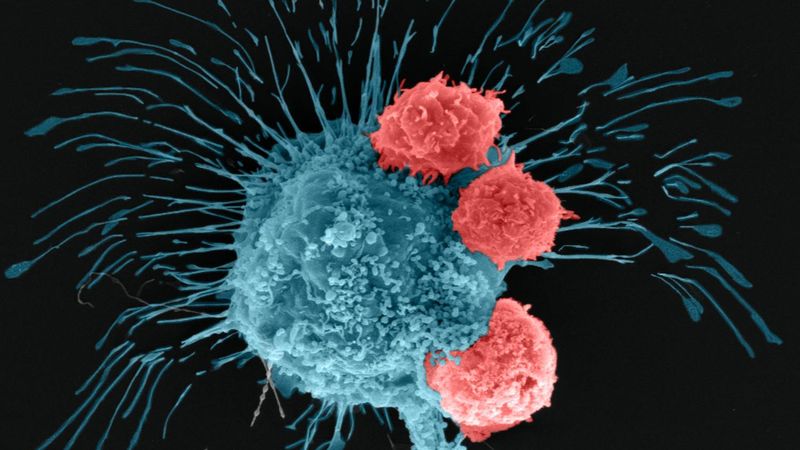 A scanning electron microscopy image shows a breast cancer cell (cyan) being attacked by T cells (red), which were engineered to recognize the cancer cells. Credit: Madhuri Dey, courtesy of the Ozbolat Lab/Penn State. All Rights Reserved.