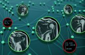 How well do explanation methods for machine-learning models work?