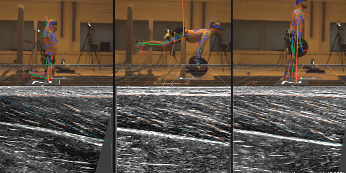 Synched ultrasound (Telemed ArtUs with Usono ProbeFix Dynamic T) and motion capturing with Vicon