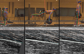 ProbeFix Dynamic crucial for ultrasound imaging of hamstring muscle and fascicle behaviour.