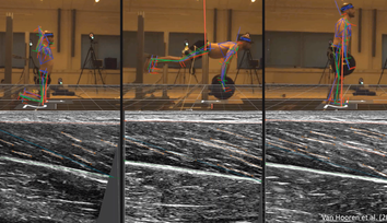 ProbeFix Dynamic crucial for ultrasound imaging of hamstring muscle and fascicle behaviour.