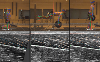 ProbeFix Dynamic crucial for ultrasound imaging of hamstring muscle and fascicle behaviour.