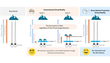 The Focus-Free Advantage of Direct Retinal Projection