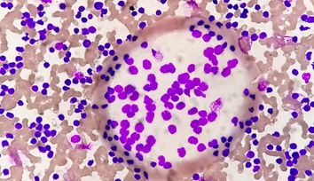 Harnessing the OKdo Nano C100 Developer Kit for Leukemia Classification