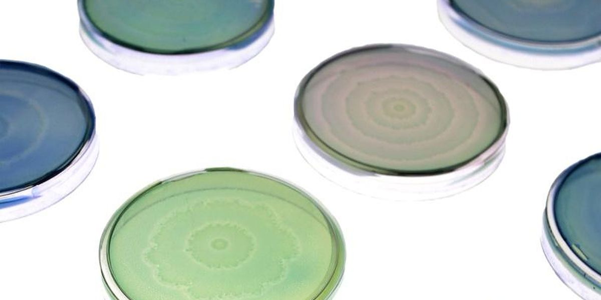 Petri dishes of engineered and native Proteus mirabilis patterns, here stained with colored dyes used for the lab's bacterial art. Credit: Soonhee Moon, Danino Lab/Columbia Engineering