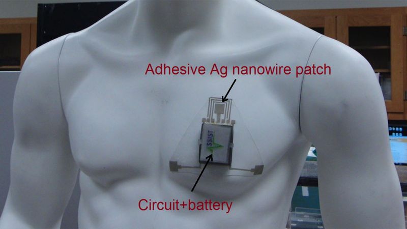 The new sensor, which tracks an individual’s skin hydration in real time, can be incorporated into a wearable patch. Photo credit: Shanshan Yao.