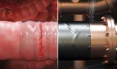 Engineers develop surgical "duct tape" as an alternative to sutures