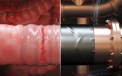 Engineers develop surgical "duct tape" as an alternative to sutures