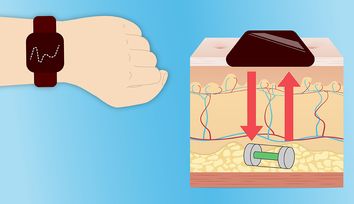 Miniature Device Offers Peace of Mind for Diabetics