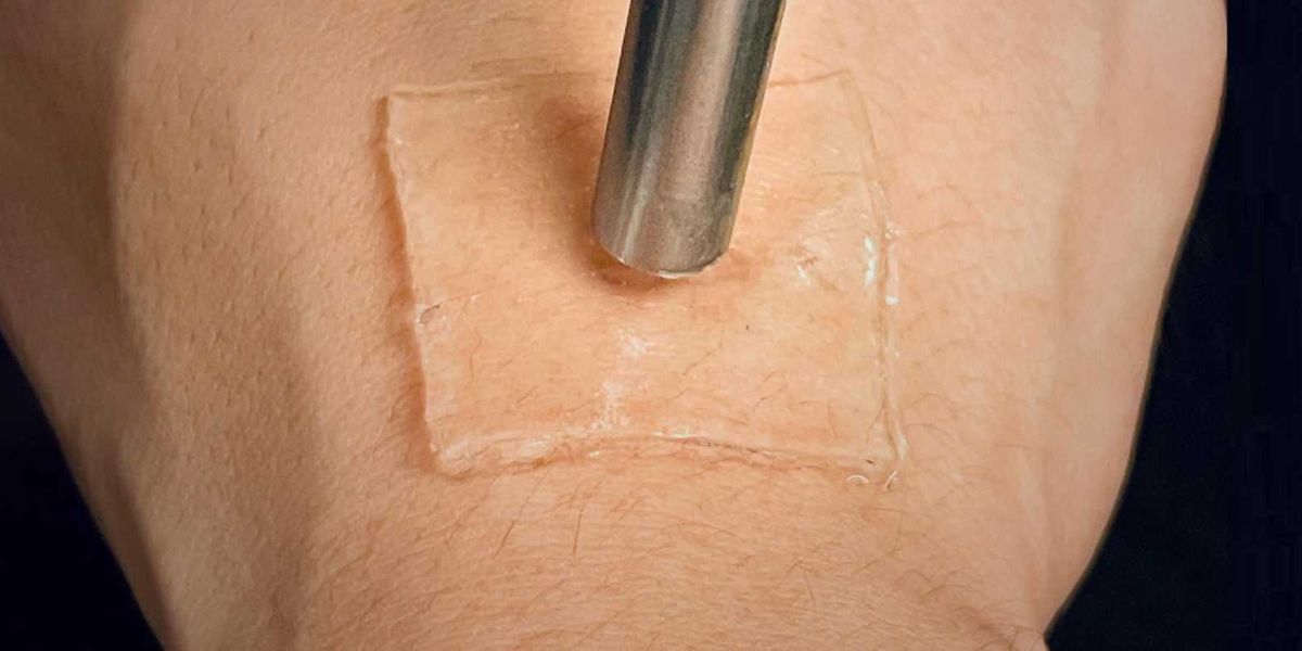 Ultrasound can be used to anchor the gel patch strongly to the skin.  (Photograph: Ran Huo & Jianyu Li, McGill University)