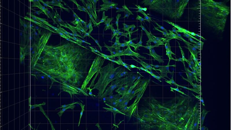 3D cell-scaffold interaction