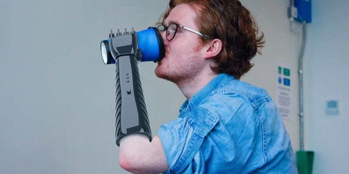 3D printed prosthetic