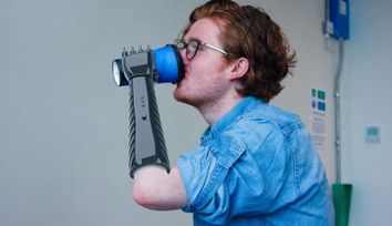 3D printed prosthetic arm providing feedbacks