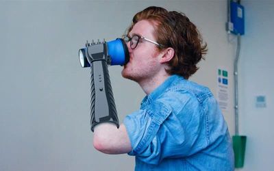 3D printed prosthetic arm providing feedbacks